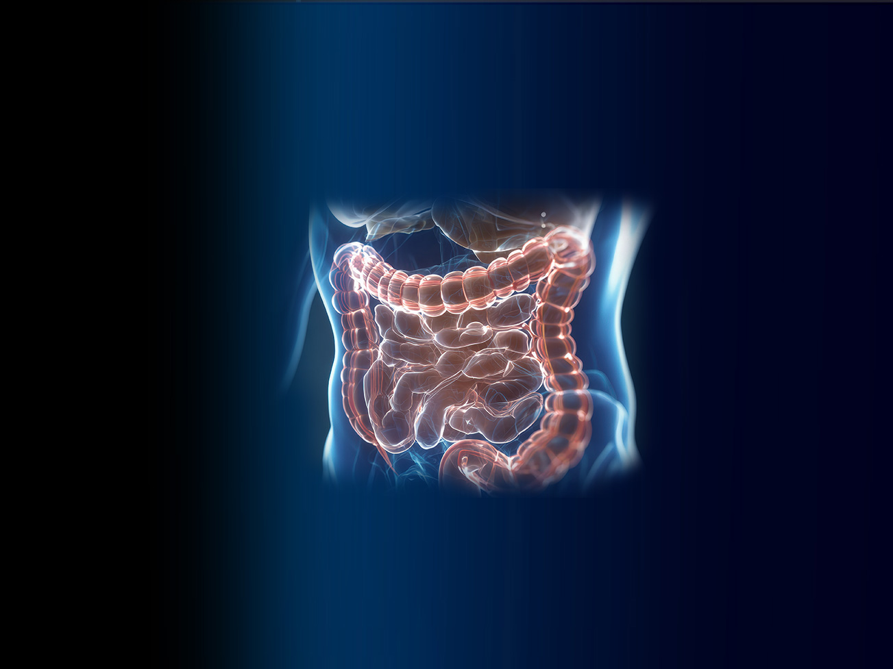chirurgie colorectale