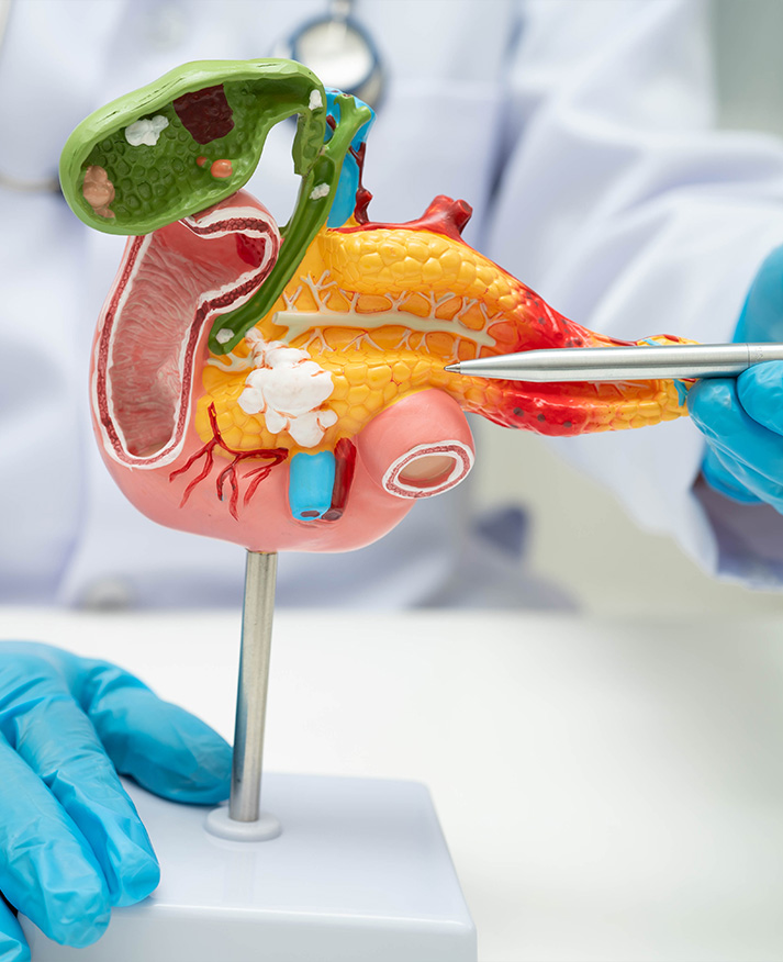 Cancer du pancr&eacute;as au Mans : prise en charge et l'arriv&eacute; de la chirurgie Robotique